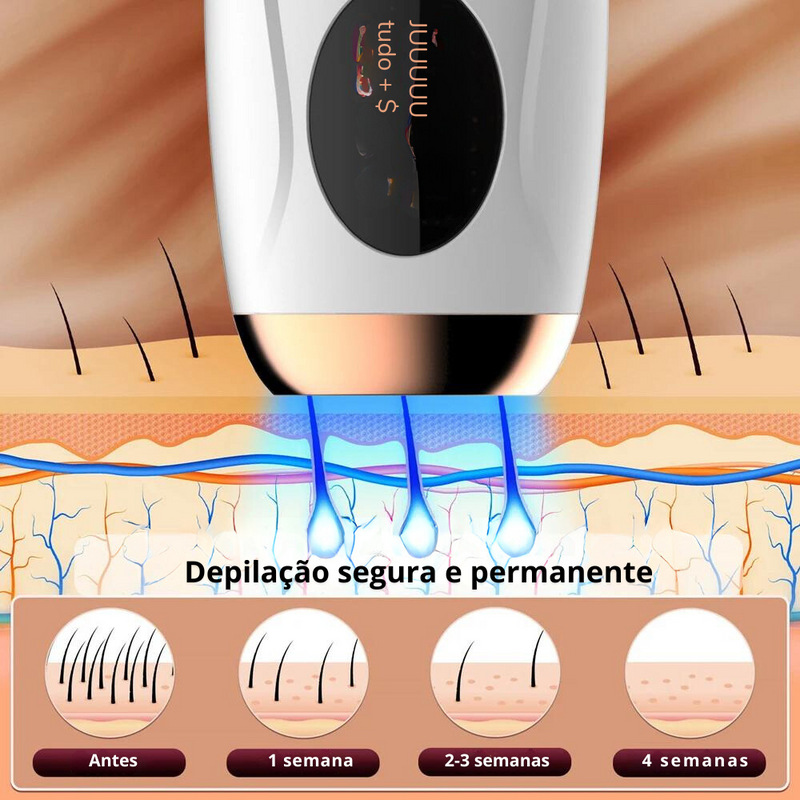 Depilador a Laser é a solução ideal para uma depilação eficaz!