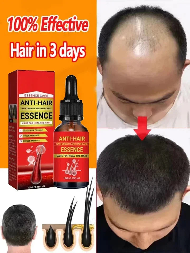 Óleo de crescimento rápido do cabelo, óleo eficaz para reparação da calvície, perda hereditária, pós-parto, cabelo seborreico, anti perda